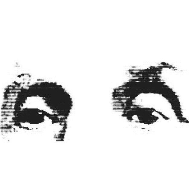 Eyes of Anton Bruckner